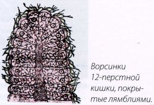 Ворсинки 12-перстной кишки, покрытые лямблиями