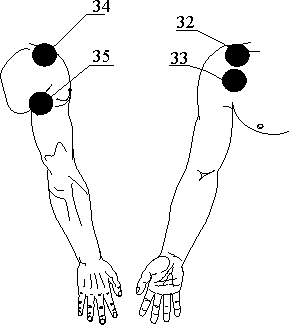 Рис.21. Поля воздействия для лечения плечевого сустава правой руки (вид спереди и сзади)