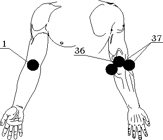 Рис.22. воздействия для лечения локтевого сустава правой руки (вид спереди и сзади)