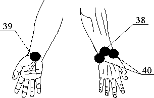 Рис.23. Поля воздействия для лечения лучезапястного сустава правой руки