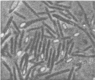 Клетки анаэробного азотфиксируюшего микроорганизма клострилий Пастера (увеличение в 2150 раз)